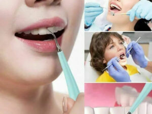 Electric Dental Teeth Whitening Kit