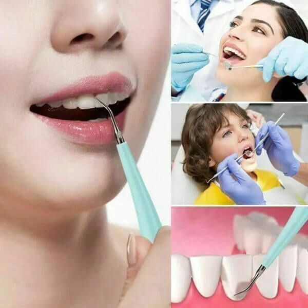 Electric Dental Teeth Whitening Kit