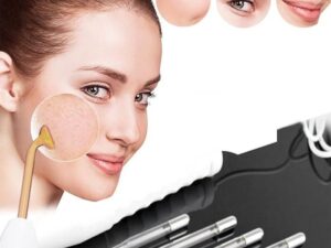 Portable High Frequency Electrotherapy Wand Device
